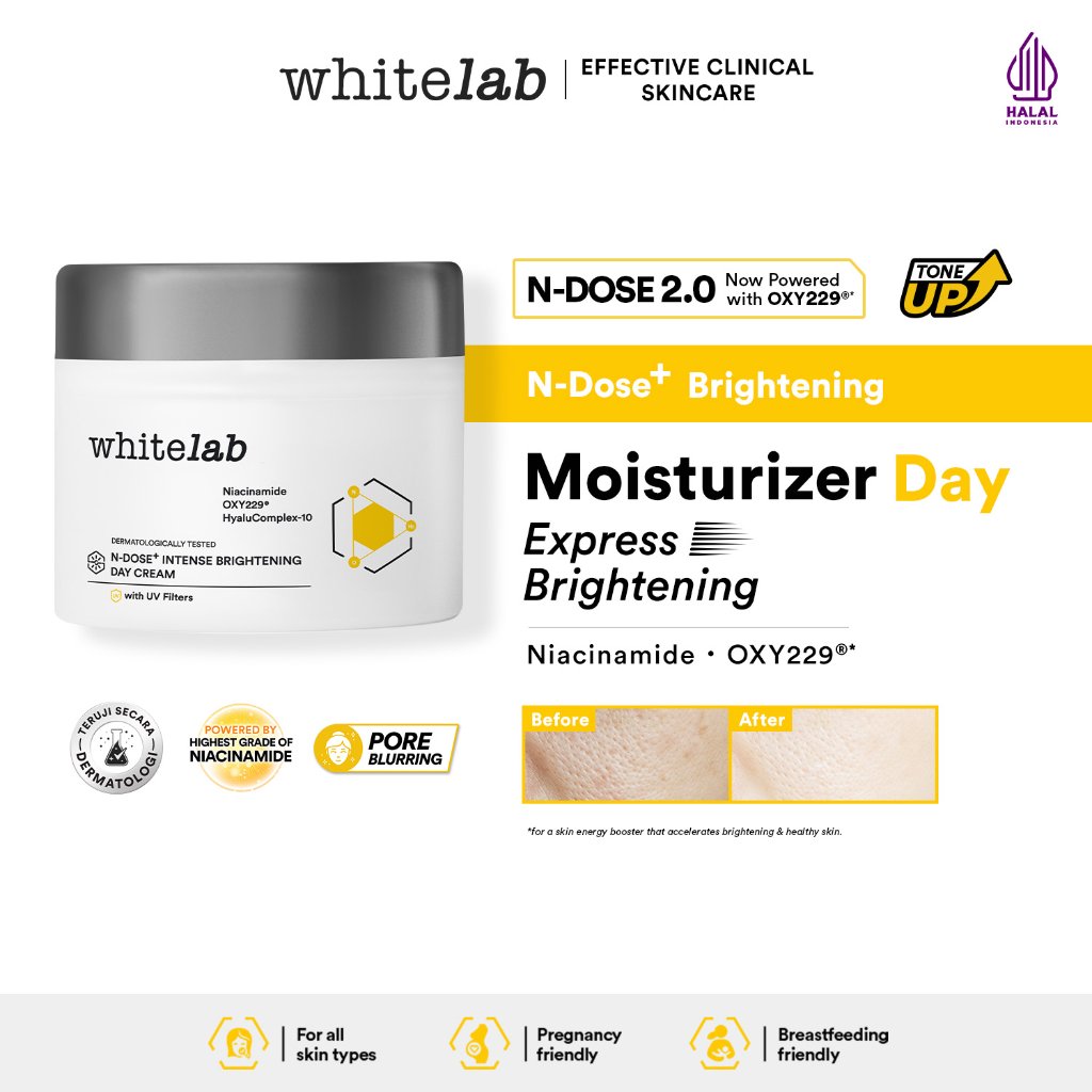 Whitelab Day Cream Brightening  - Pelembap Krim Pagi Pencerah Wajah Untuk Kulit Oily N-Dose+ 2.0