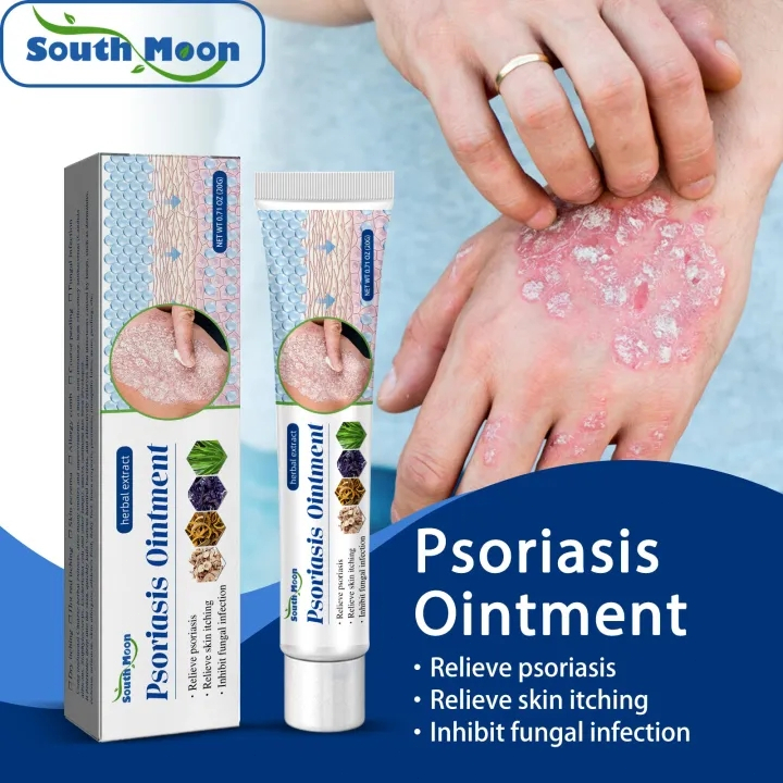 Psoriasis Cream Salep Khusus Psoriasis Salep Eksim Kurap Pada Kulit Kepala Kutu Air