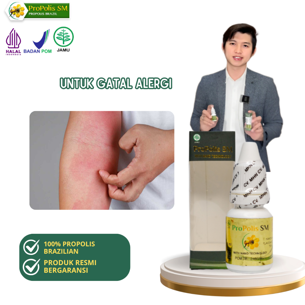 Propolis SM - Obat Alergi Kulit Bintik Bintik Merah Di Wajah, Obat Alergi Makanan, Alergi Dingin, Ku