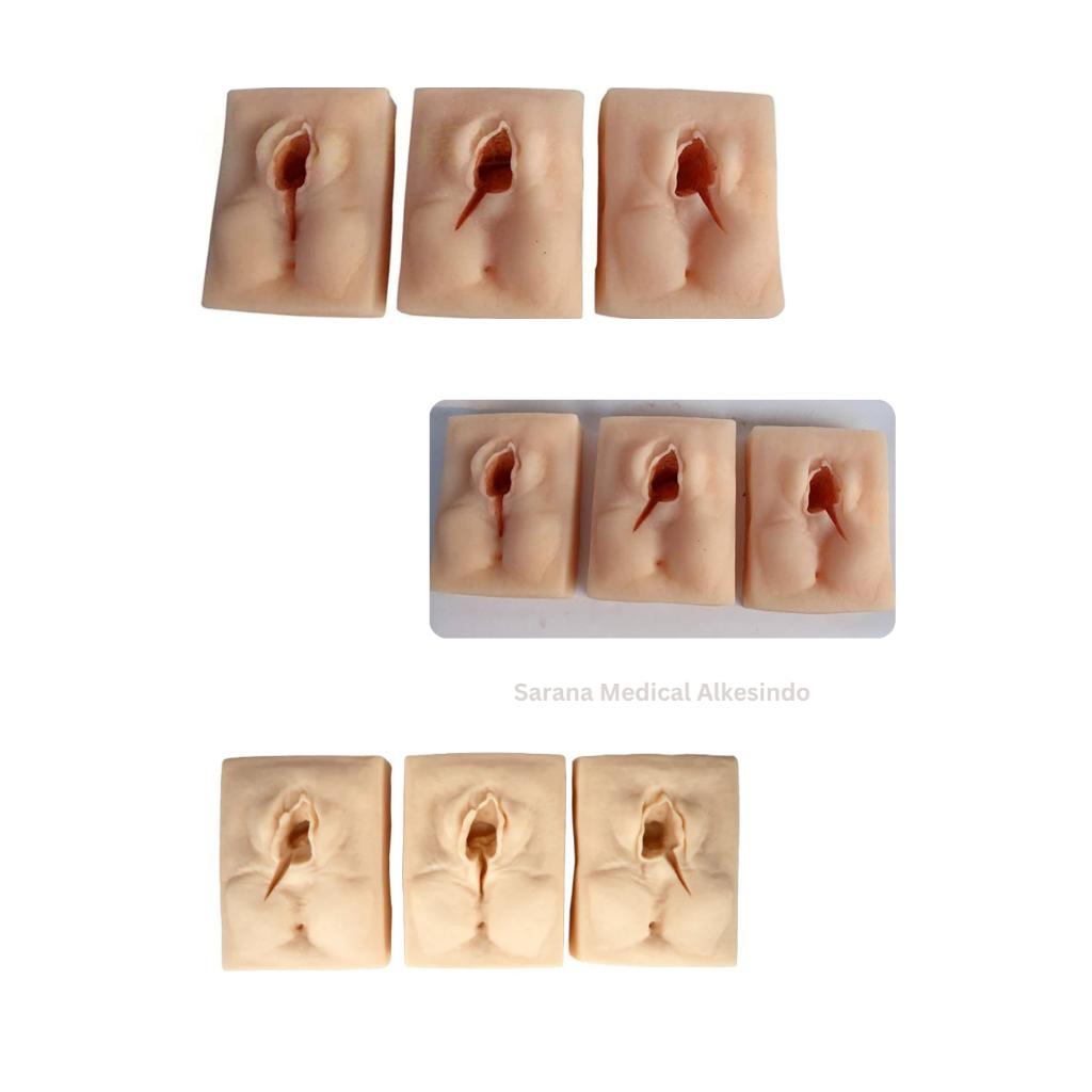 Manekin/Manikin/Alat Peraga/Phantom/Manekin Model Jahitan Vulva – Simulator Episiotomi & Penjahitan 