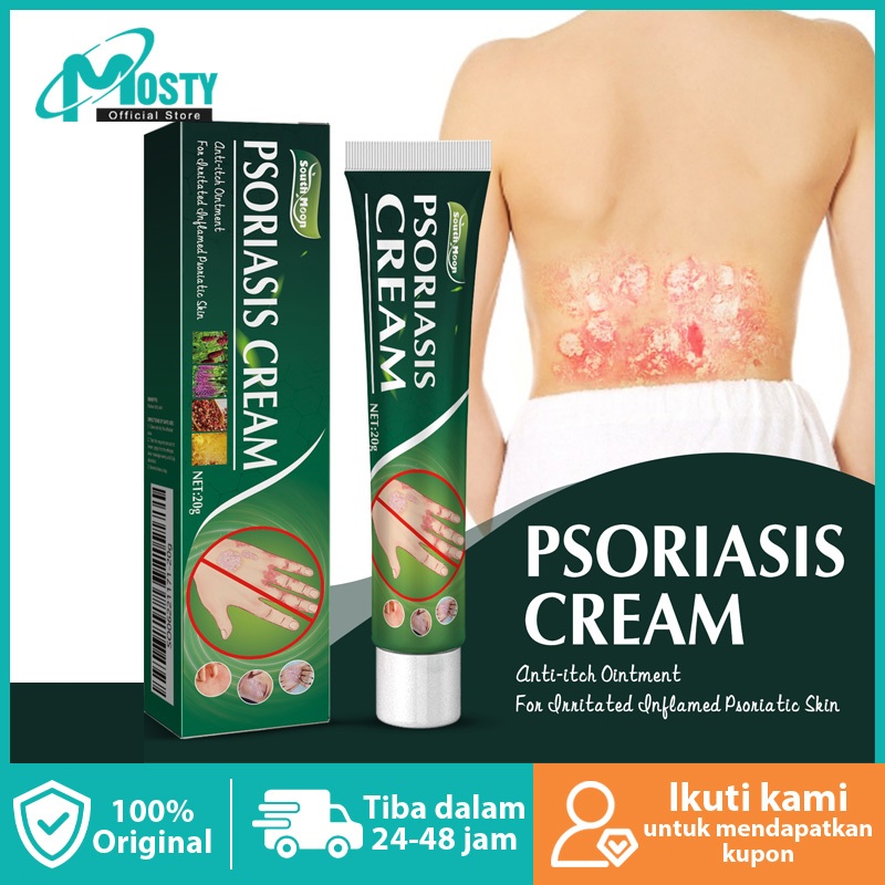 Mosty South Moon Psoriasis Ointment 20g Obat Gatal Salep Psoriasis Eczema Cream Paling Ampuh Kulit K