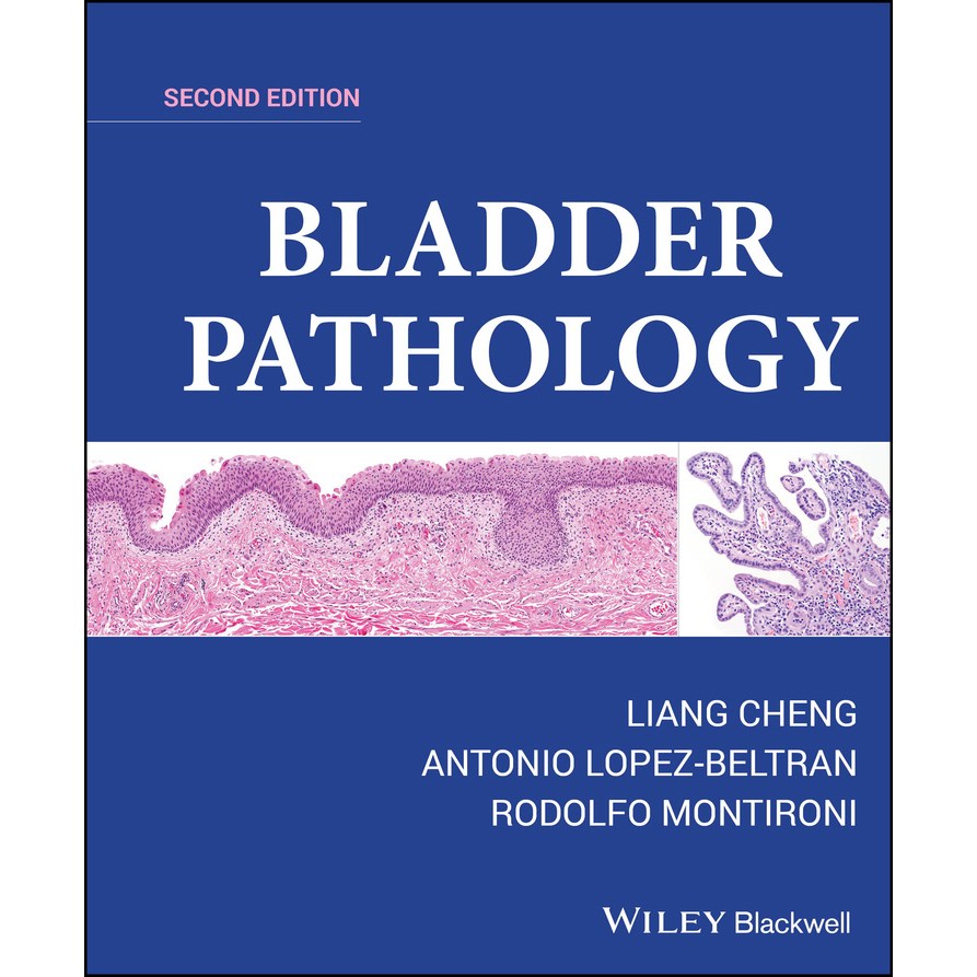 BLADDER PATHOLOGY SECOND EDITION LIANG CHENG, ANTONIO LOPEZ-BELTRAN, RODOLFO MONTIRONI