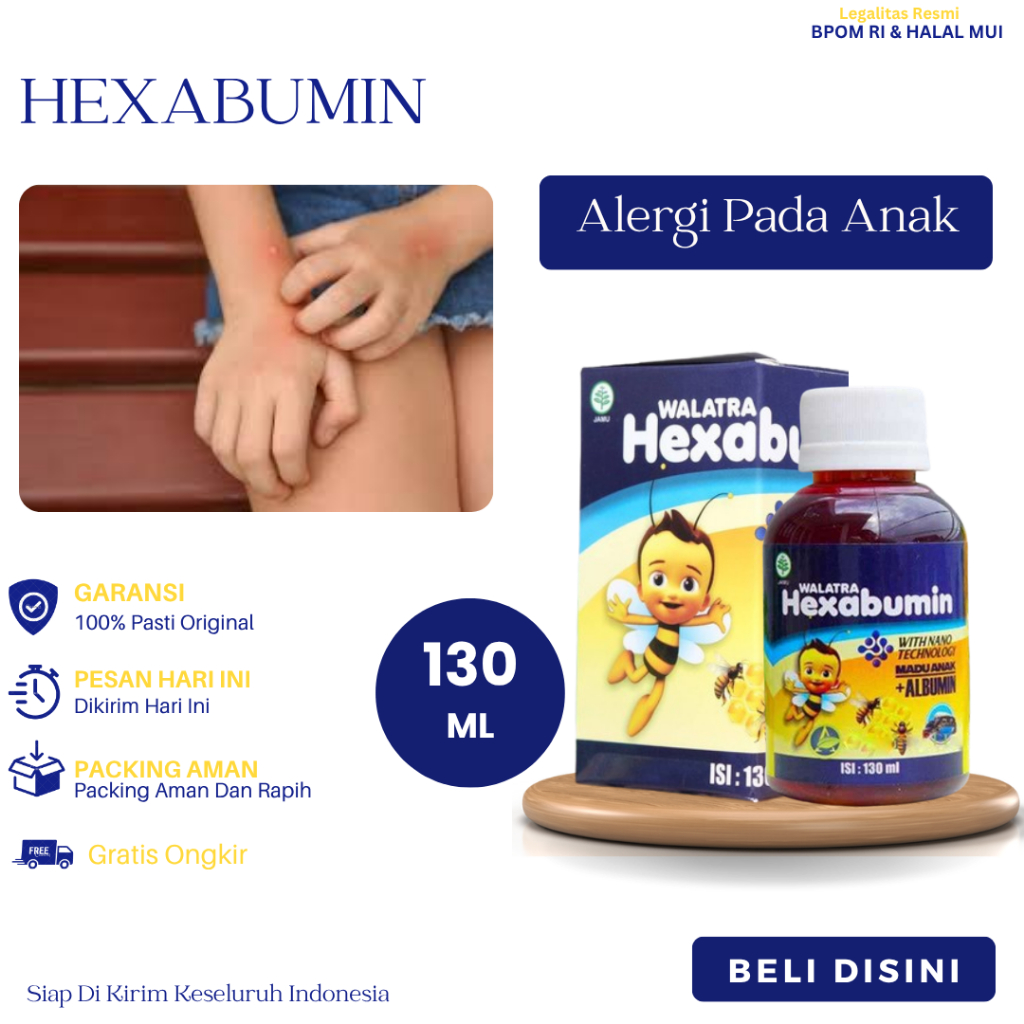 Obat Alergi Pada Anak, Alergi Makanan, Alergi Debu, Alergi gatal, Alergi Dingin, Alergi Parah, Benge