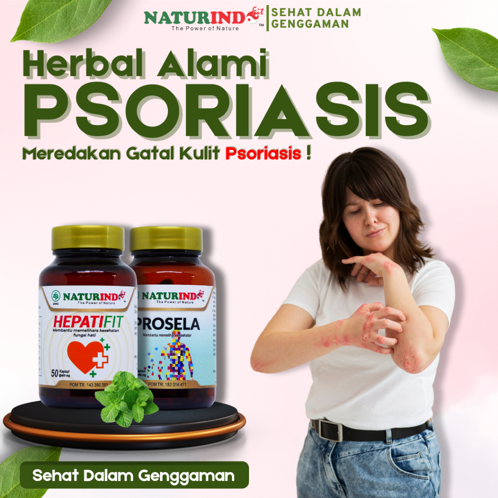 Obat Gatel Psoriasis Kulit Ampuh Autoimun Gatel Alergi Eksim Kulit Bersisik Ruam Merah Biduran