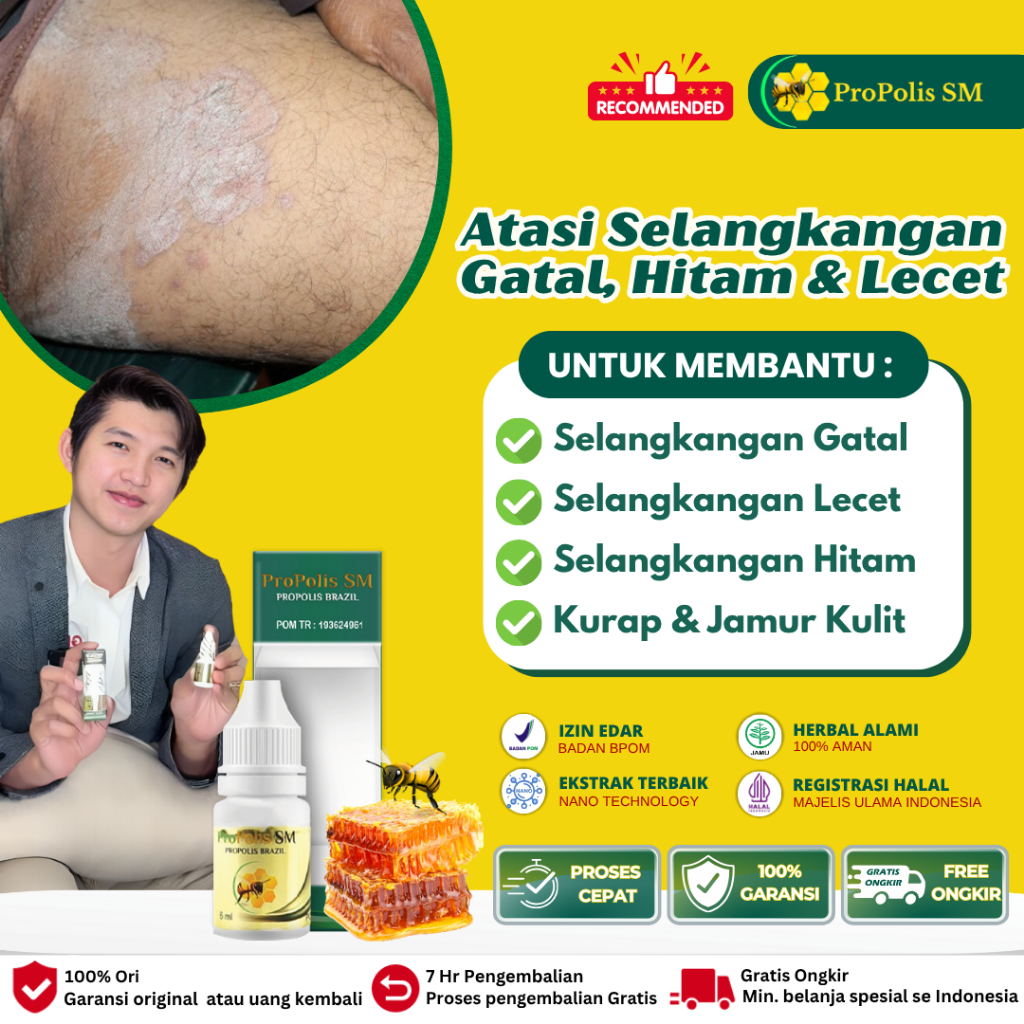 Propolis sm obat gatal selangkangan, salep gatal selangkangan, obat selangkangan gatal gatal, obat s