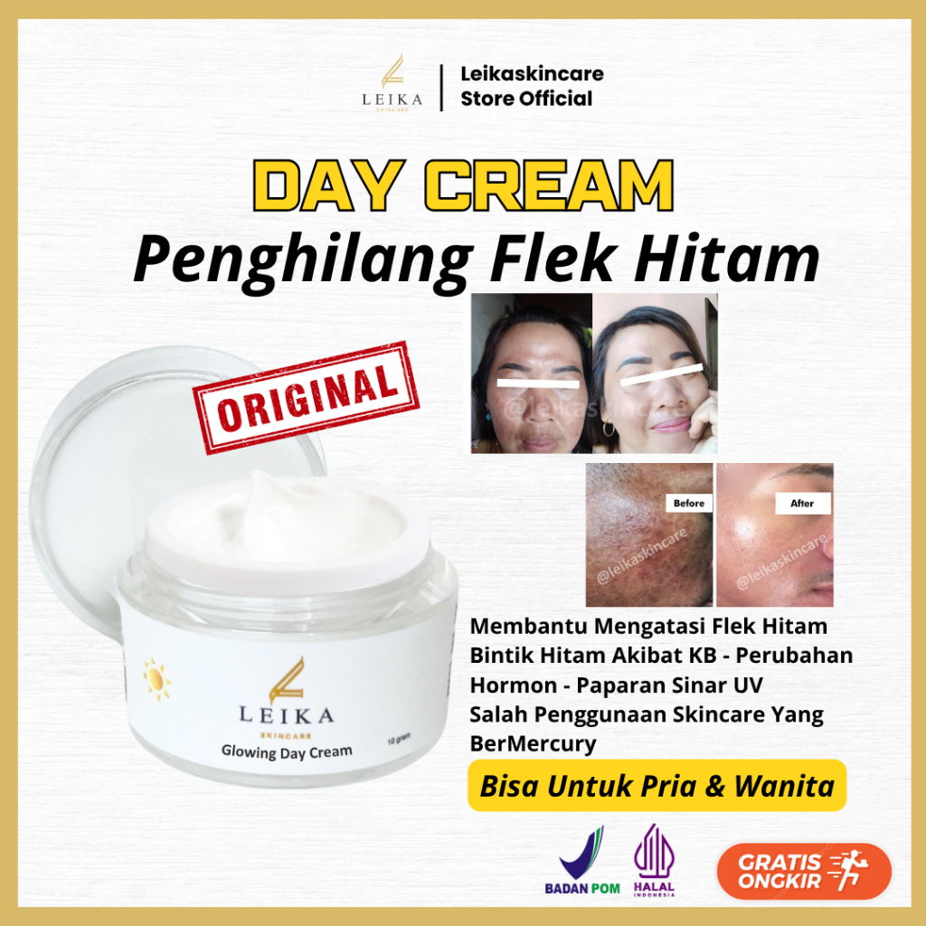 Cream penghilang flek hitam membadel Pria BPOM Skincare penghilang flek hitam cream penghilang flek 