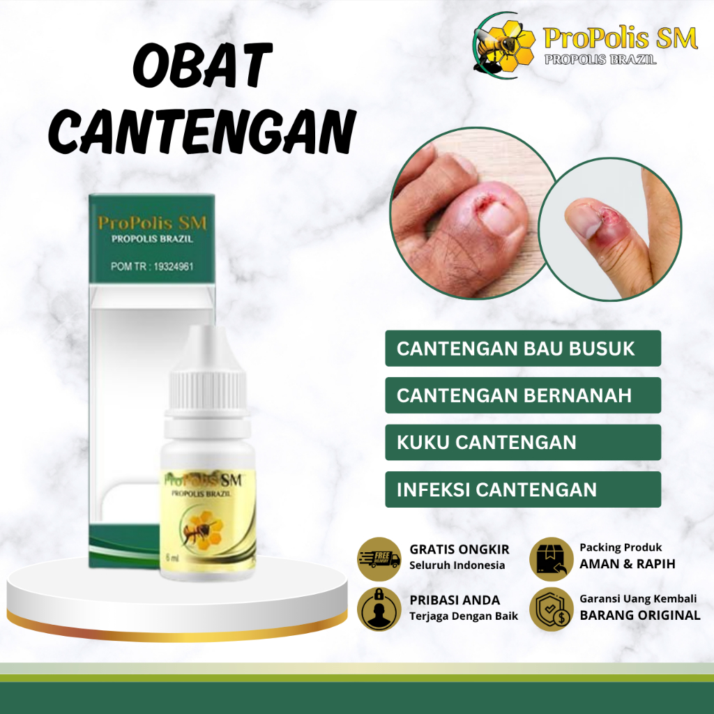 Obat Kuku Cantengan, Obat Cantengan Jempol Kaki Tangan, Obat Cantengan Bernanah, Obat Cantengan Para