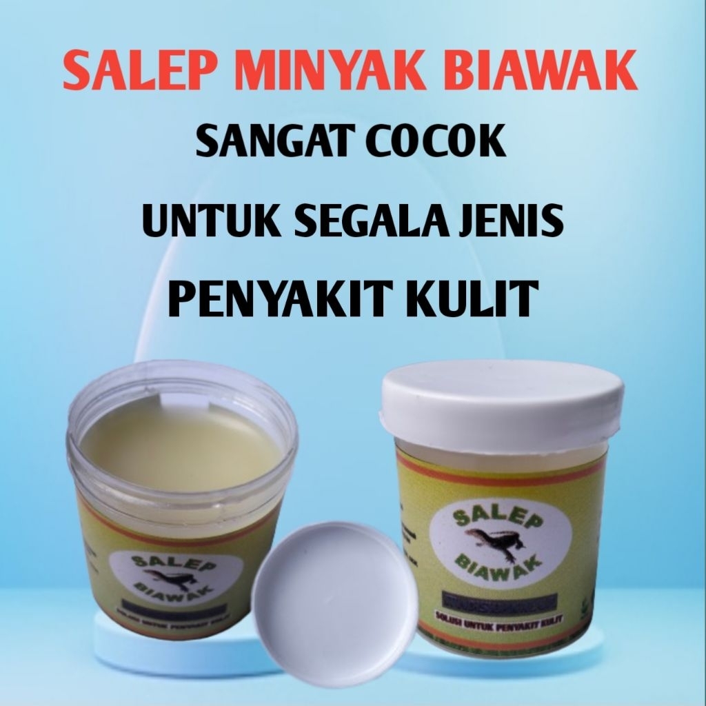 Salep Minyak Biawak Mengobati Gatal Kulit Cacar Sporiasis Kutu Air Eksim Koreng Luka Bakar Kurap Kud