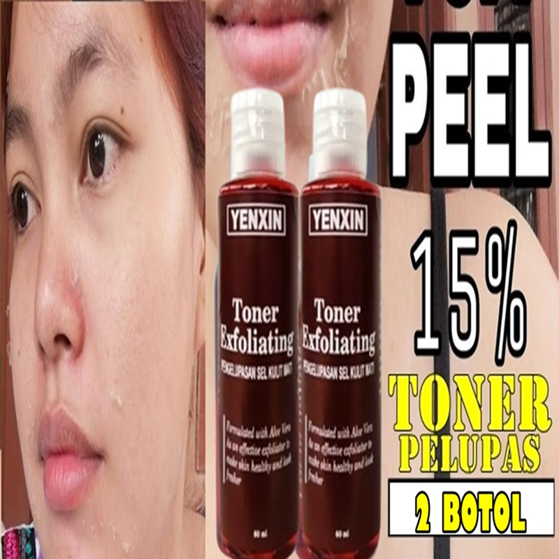 Bundling bpom toner kelupas original 100ml toner whitening toner badan toner fleksol Gitaskinori