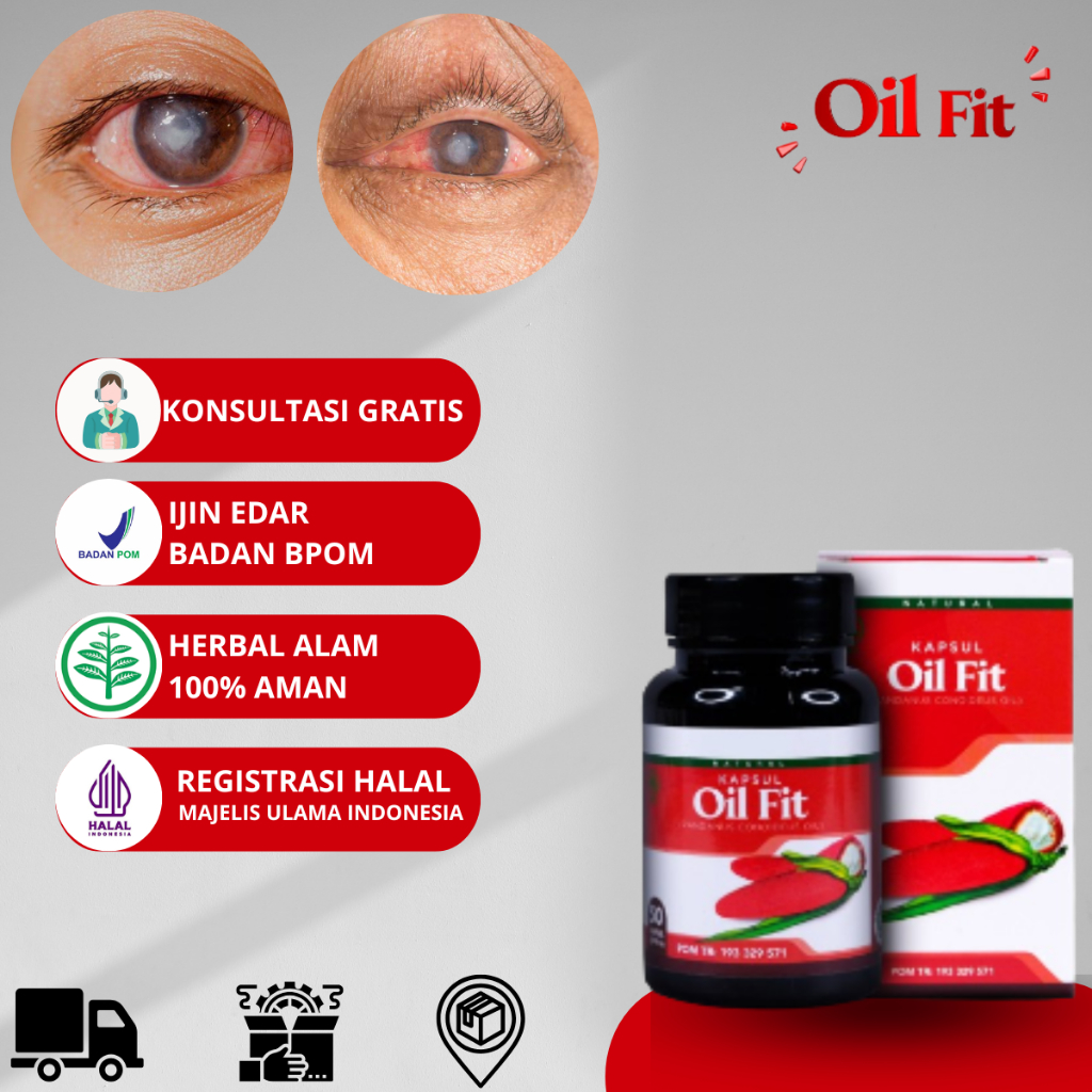 Obat Tukak Ulkus Kornea Penglihatan Buram, Obat Ulkus Kornea, Luka Pada Mata, Obat Penghilang Mata T