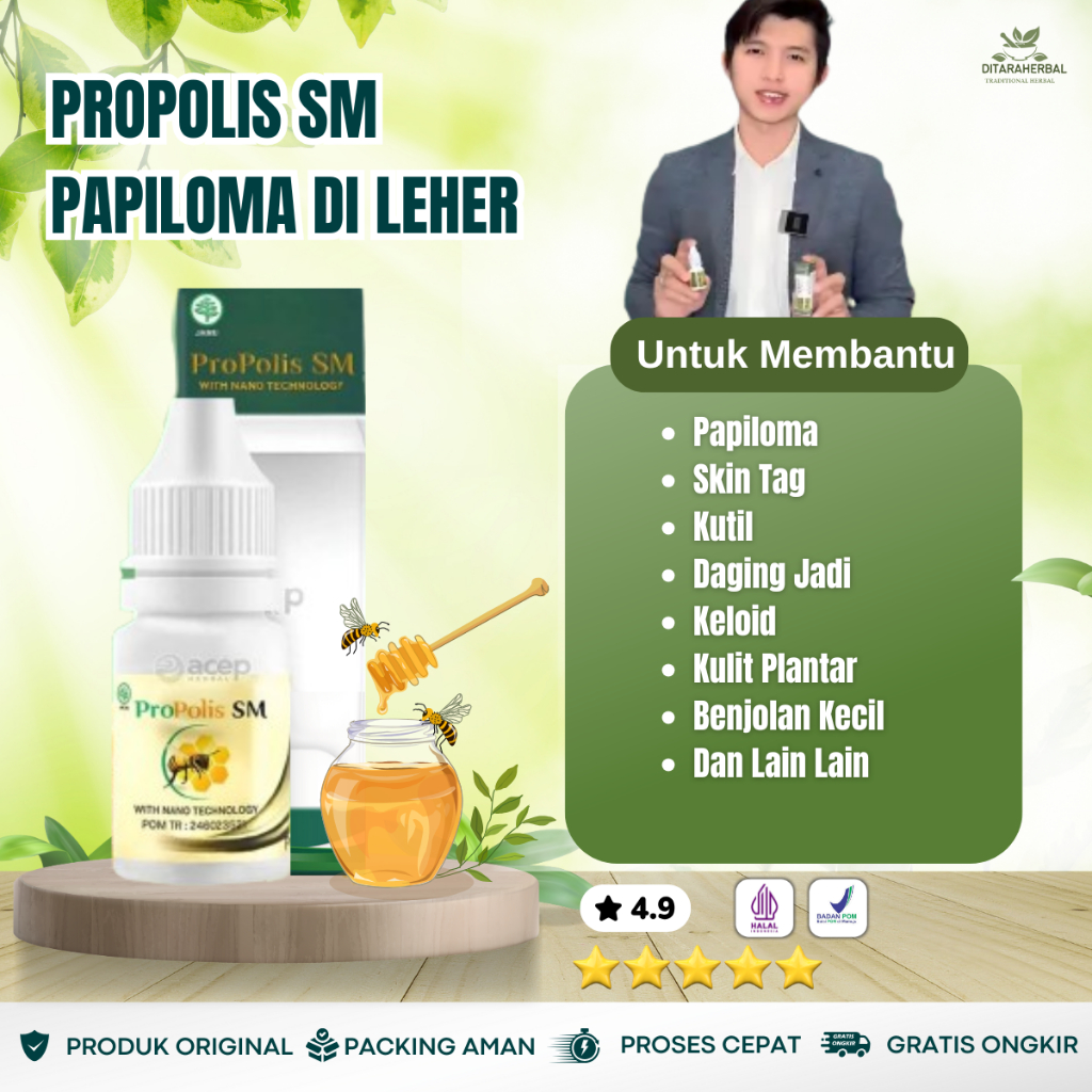 Obat Papiloma Di Leher, Obat Tetes Papiloma, Obat Penghilang Papiloma, Obat Papiloma Di Wajah, Obat 