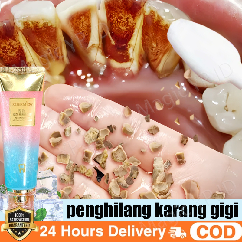 Pasta Gigi Pemutih Probiotik Penghilang Karang Gigi Odol Pemutih Gigi dan Karang Gigi Perontok Karan
