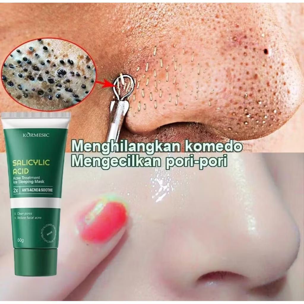 Kormesic Salicylic Acid Acne Sleeping Mask || BPOM