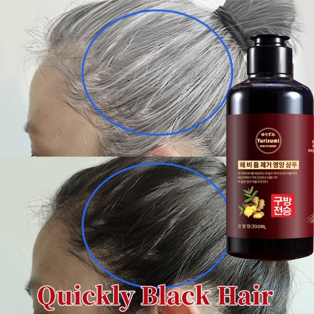 Shampo Yurizumi King of Ginger – Rahasia Rambut Hitam Alami Tanpa Uban 300ml