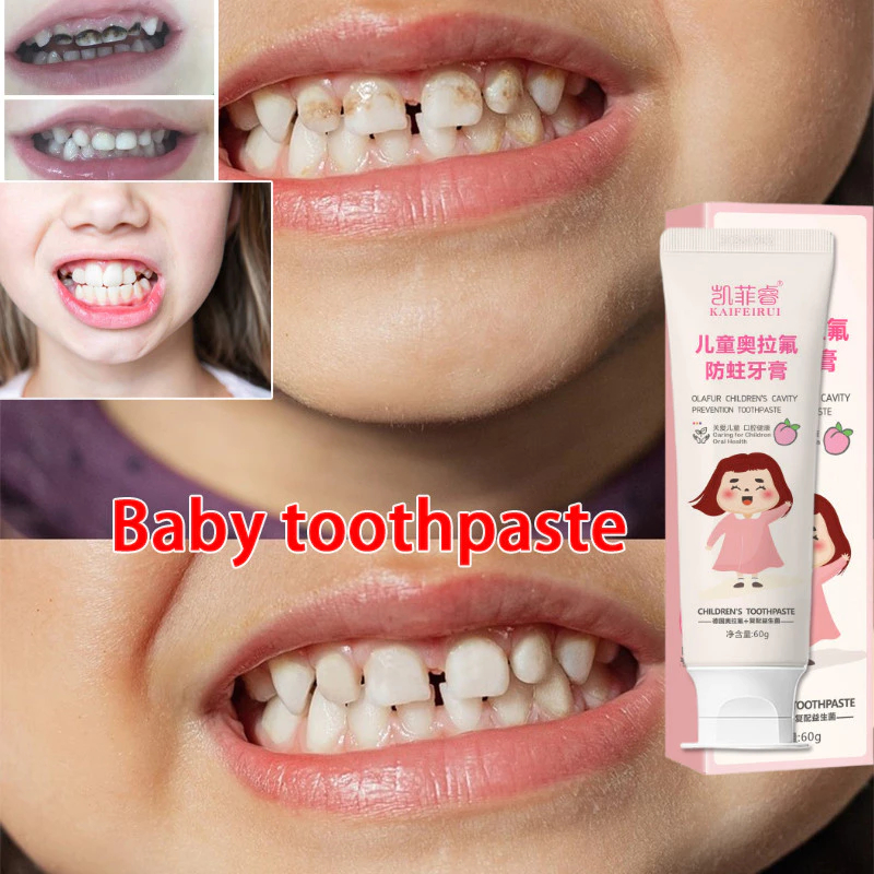 Pasta Gigi Anak Pasta Gigi Bayi Pemutih Gigi Perontok Kids Toothpaste Karang Gigi Pembersih Karang G