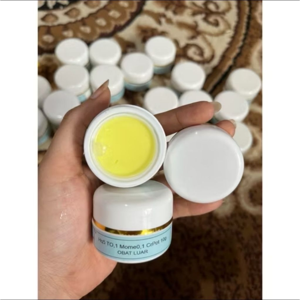 Cream Flek Hq5 TO,1 Mome0,1 CrPot / Flek Parah 10g