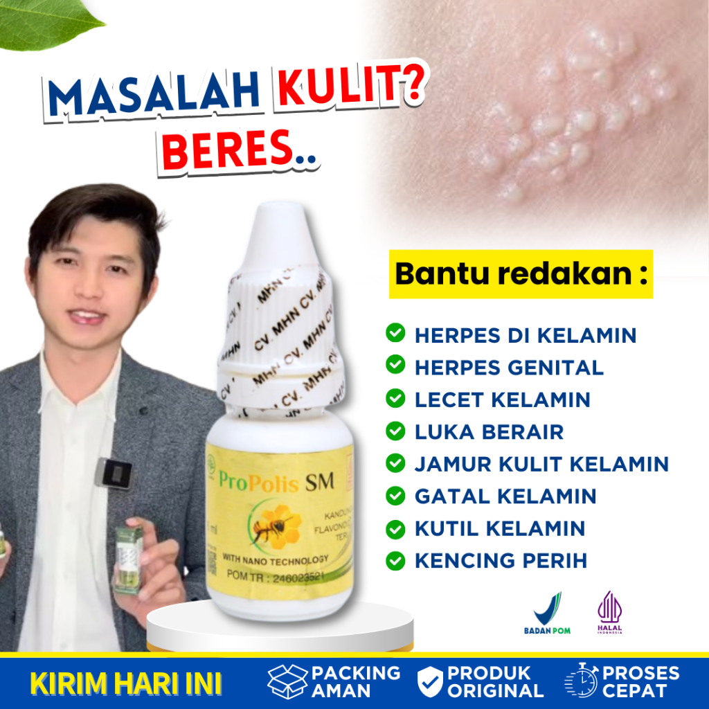 Obat Herpes di Kelamin Pria Wanita Lecet Luka Kelamin Herpes Genital Propolis SM Original 100%