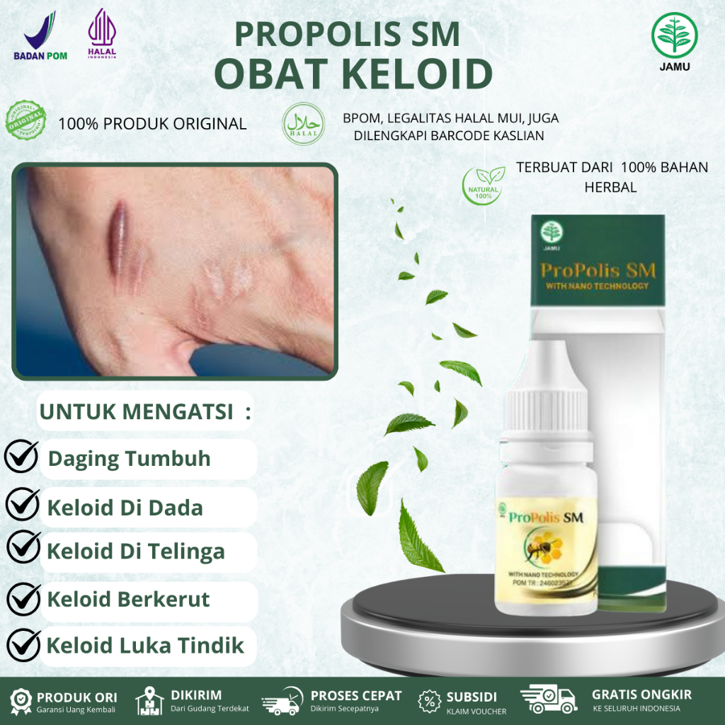 Propolis  SM Untuk Penghilang Keloid Di Telinga, Penghilang Keloid Berkerut, Keloid Menonjol Tahunan