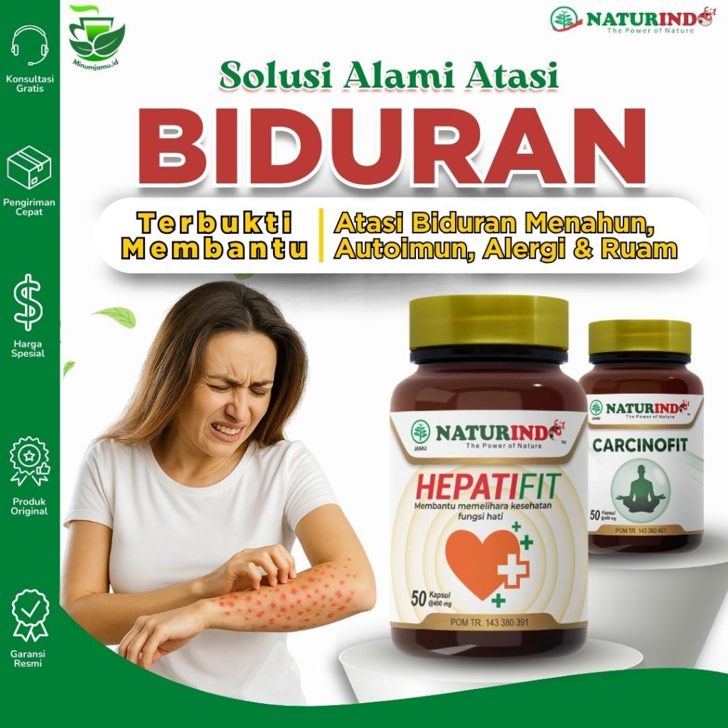 Obat Gatal Kulit Alergi Dingin Biduran Gatal Alergi Herbal Bentol Kulit, Obat Biduran Kronis, Alergi