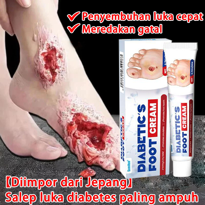 20g Luka baring Penyembuhan luka Luka diabetes Krim dekubitus Mengobati dekubitus Penyembuhan Luka K