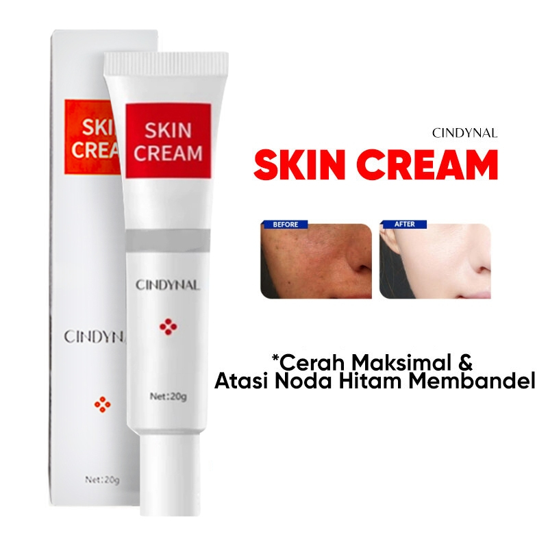 [20g] BPOM CINDYNAL Skin Cream Removal / Krim Wajah Pria & Wanita Glowing Cepat Siang Malam