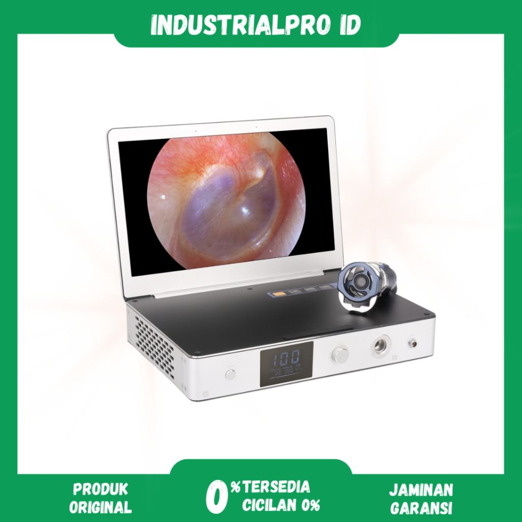 Camera Endoscopy | Kamera Endoscopi Full HD | Endoscopy Camera untuk Klinik & Rumah Sakit - Camera O