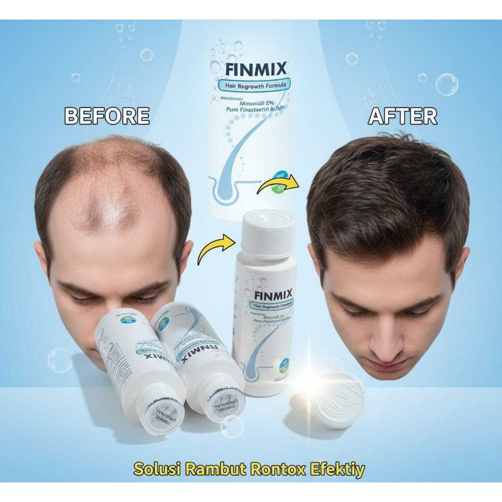 Finmix Minoxidil 5% Pure Finas 0,05% 60Ml ORIGINAL USA 100%