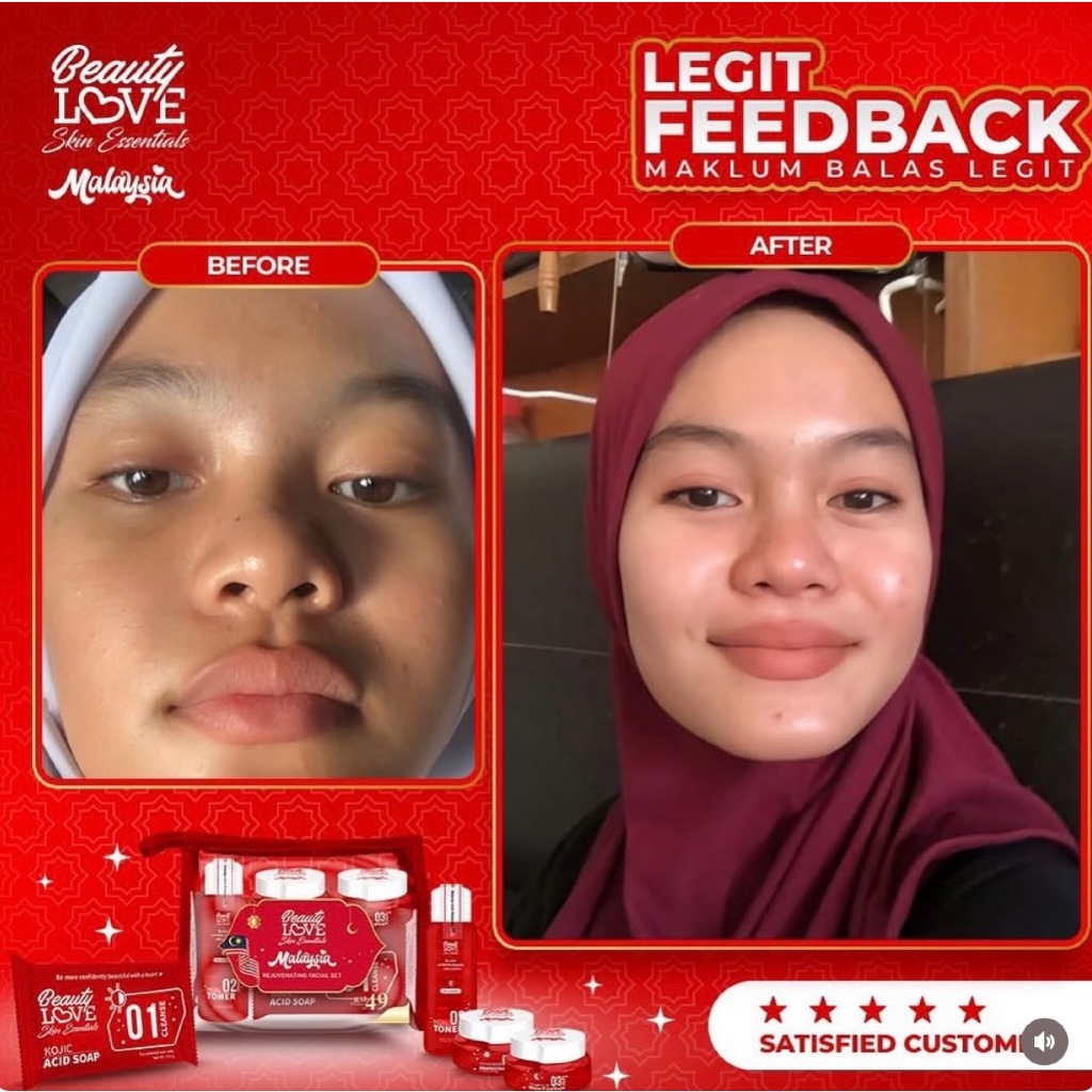 TERMURAH PAKET LENGKAP KRIM CREAM SET BEAUTYLOVE BL MALAYSIA BEAUTY LOVE JAMINAN ORIGINAL ASLI REJUV