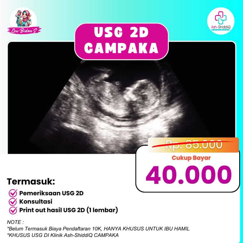 USG 2D CAMPAKA PROMO -Print Out hasil USG 2D(1 Lembar), Konsultasi,Pemeriksaan USG 2D