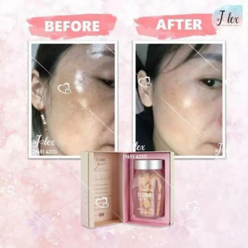 DVINE COLLAGEN KEMASAN BARU IBLING ORIGINAL ISI 30 & 60