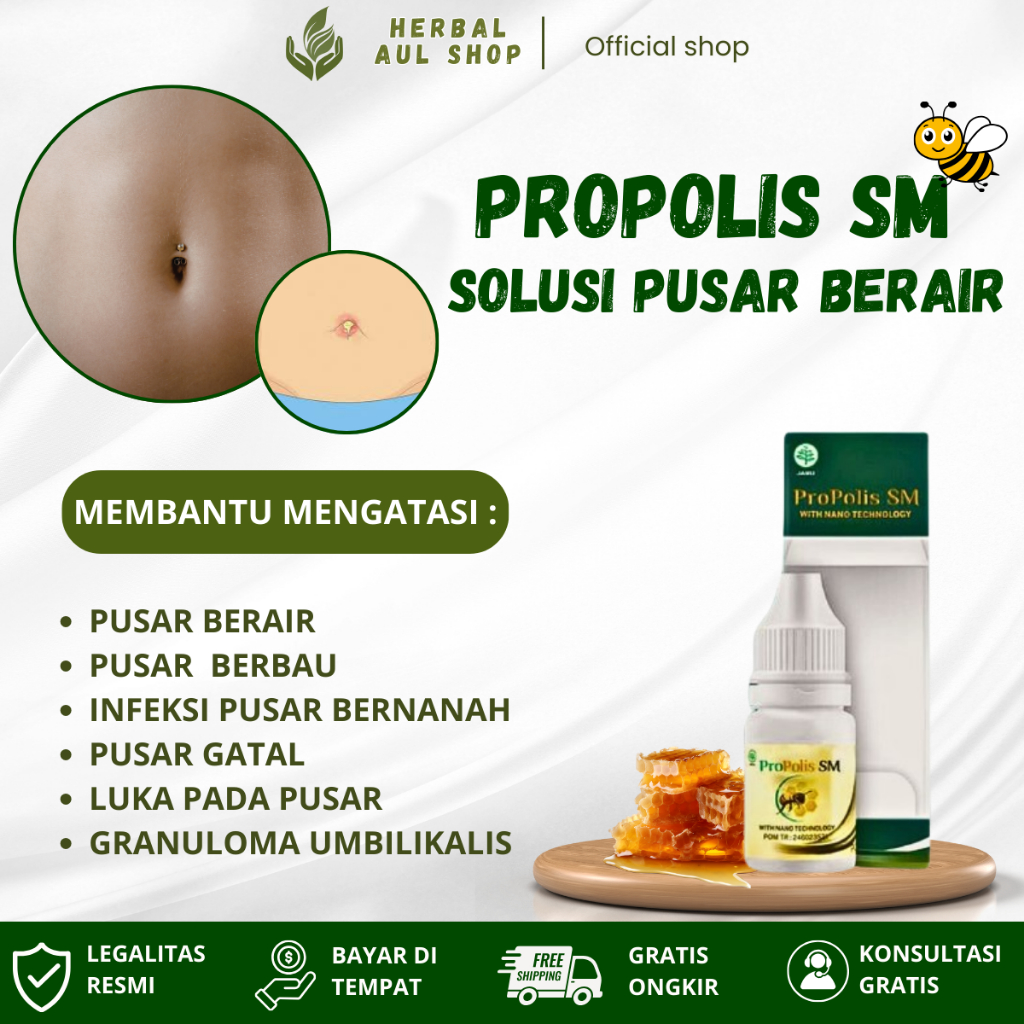 Propolis SM Obat Pusar Berair, Berbau, Infeksi Pusar Bernanah, Pusar Gatal, Luka Pada Pusar, Granulo