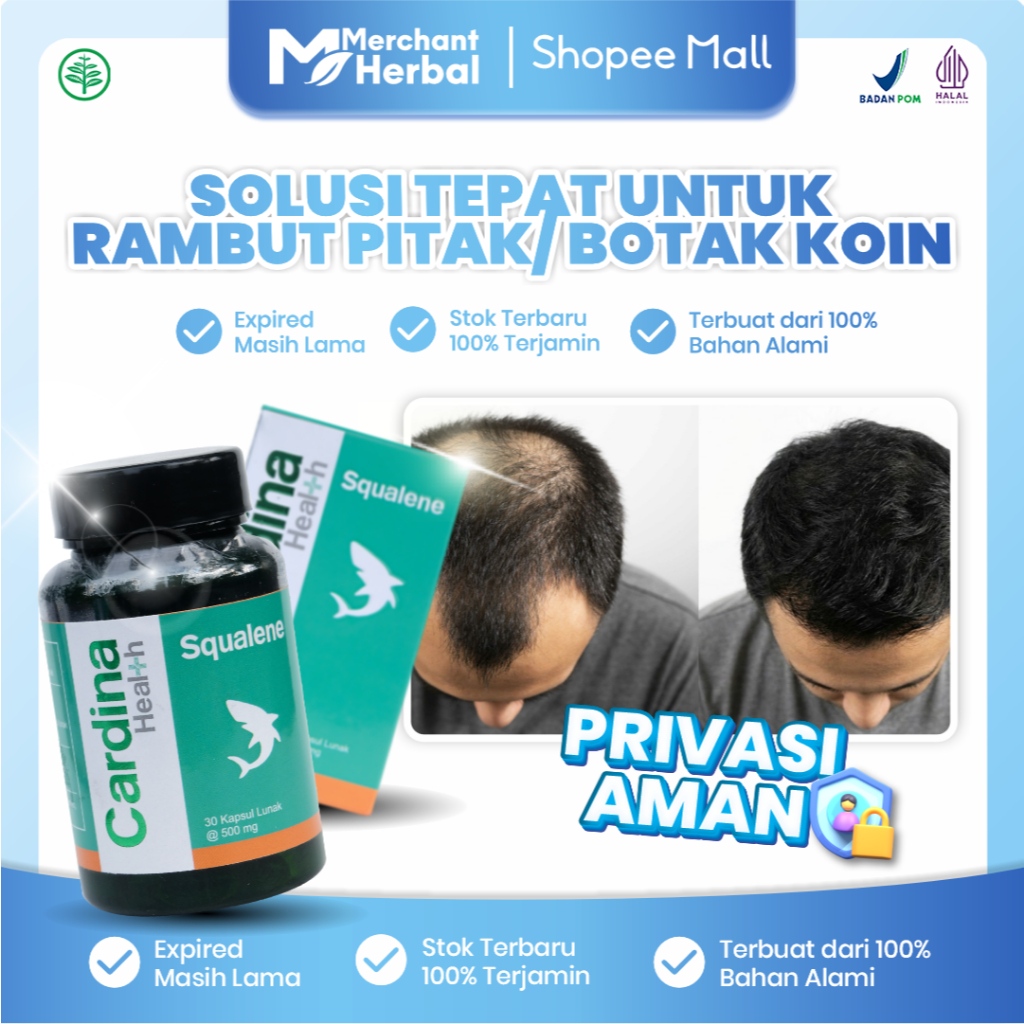 Cardina Squalene - Obat Rambut Pitak Alopecia Areata, Rambut Botak Koin, Obat Penumbuh Rambut Botak,