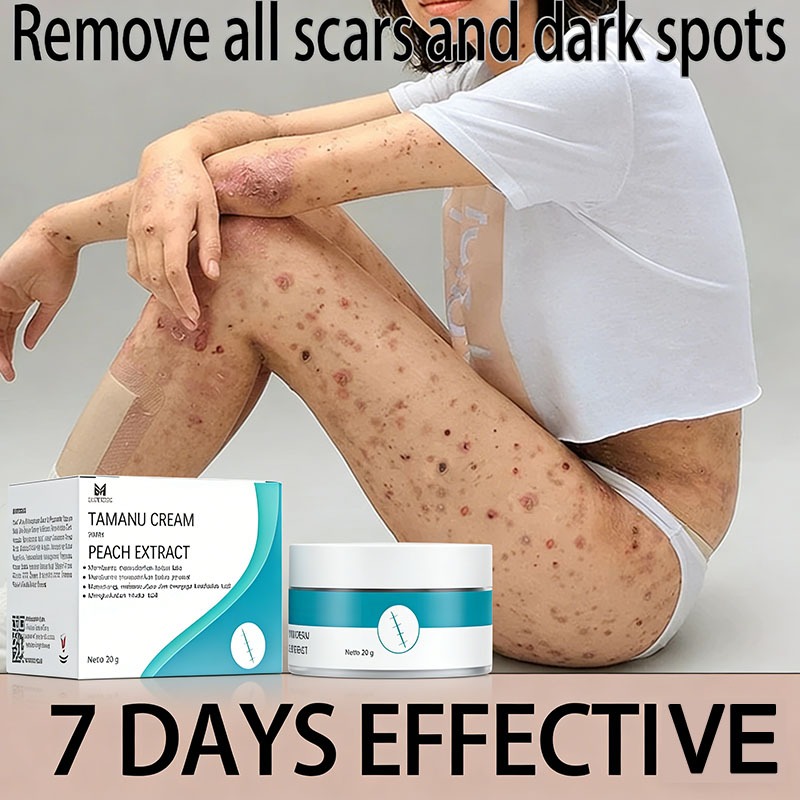 Krim Penghilang Bekas Luka Obat Penghilang Bekas Luka Bekas Luka Jahitan Gigitan Serangga Bekas Luka