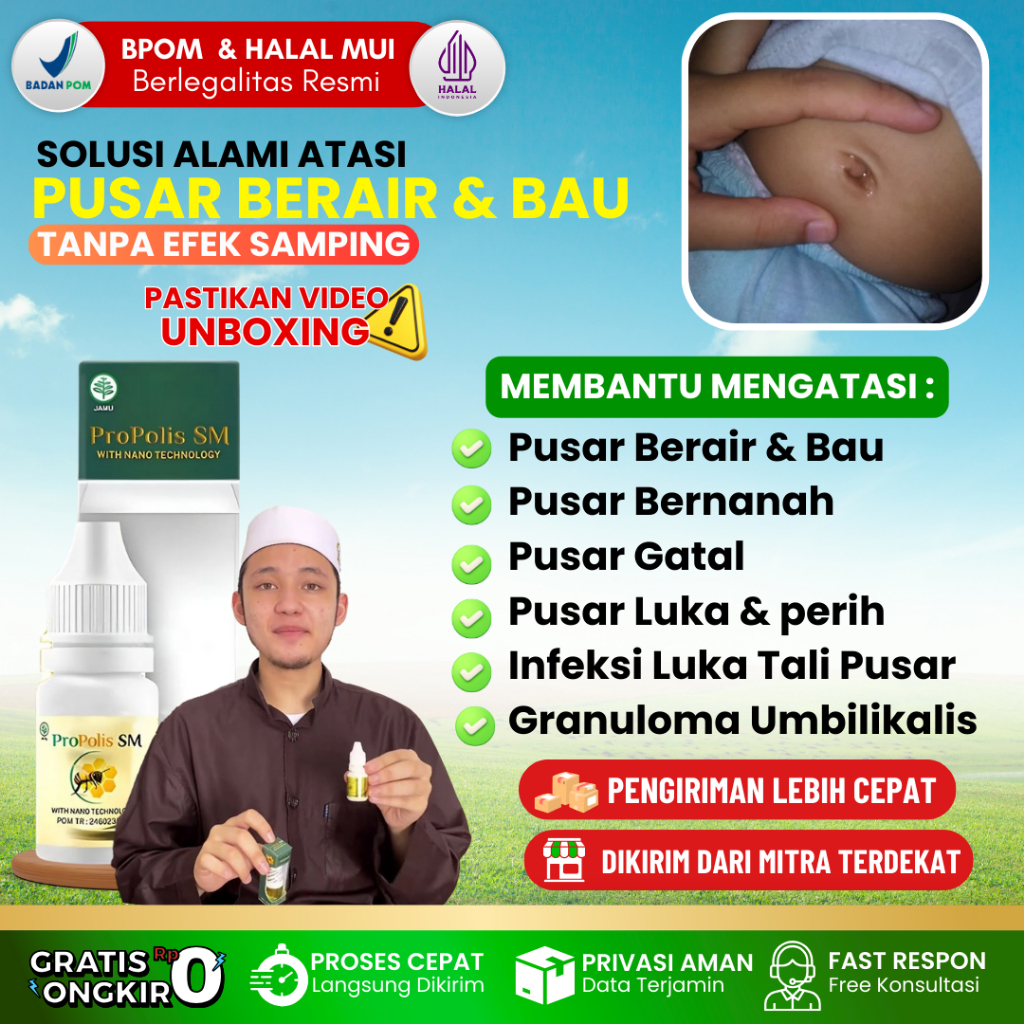 Obat Tetes Oles Pusar Berair, Pusar Berair Dan Bau, Pusar Gatal, Pusar Bengkak, Infeksi Tali Pusar B