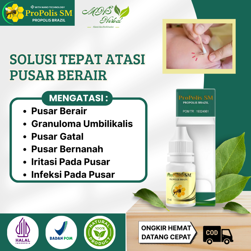 Obat Pusar Berair, Granuloma Umbilikalis, Pusar Terasa Gatal, Pusar Bau, Infeksi Pusar Bernanah, Pus