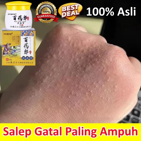 Salap Gatal Kulit Yang Ampuh Salep Eksim Kering Paling Ampuh Obat Jamur Kulit Salep Eksim Kering Pal