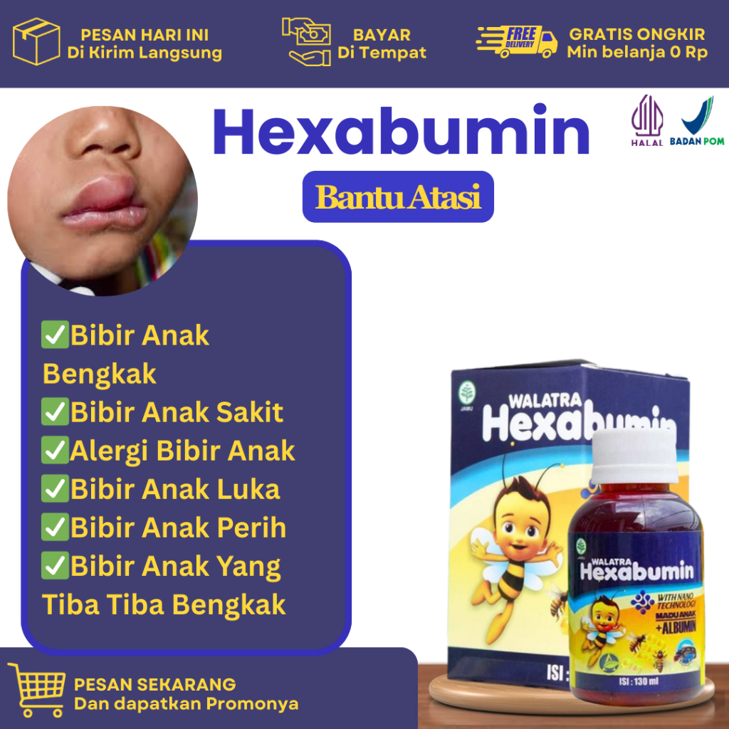 Obat Untuk Bibir Anak Bengkak, Alergi Bibir Anak, Bibir Luka, Bibir Gatal, Bibir Anak Perih, Pengemp
