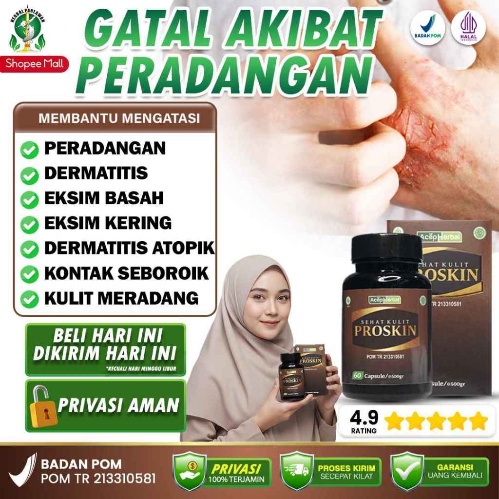 Obat Herbal Gatal Akibat Peradangan, Dermatitis, Eksim, Dermatitis Atopik, Seboroik, Kulit Meradang 