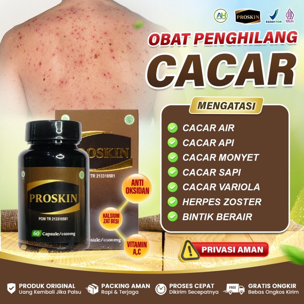 Obat Cacar Air, Cacar Api, Luka Cacar, Cacar Monyet, Herpes Zooster, Bintik Berair, Cenang - Proskin