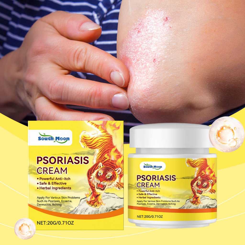 salep jamur kulit RACIKAN JEPANG  salep eksim salep gatal paling ampuh salep gatal 20g Kulit Kepala 