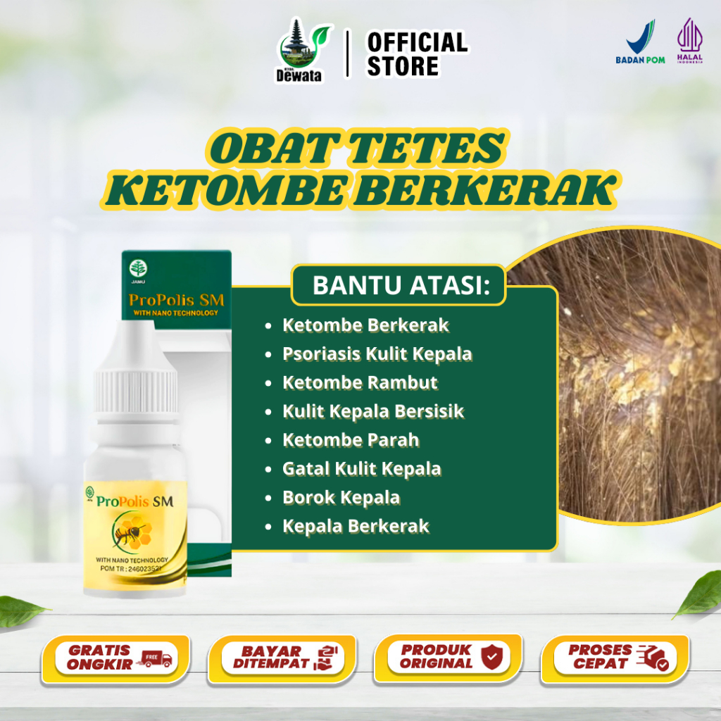 Obat Penghilang Ketombe Berkerak, Ketombe Basah, Ketombe Kering Untuk Anak Dewasa - Propolis SM