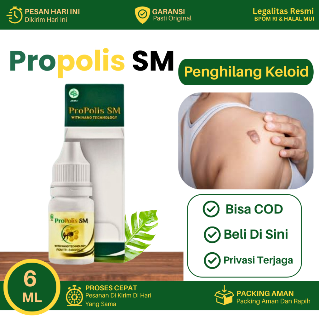 Obat Untuk Penghilang Keloid, Keloid Menonjol Tahunan, Benjolan Keras, Bekas Luka Yang Lama, Penghil
