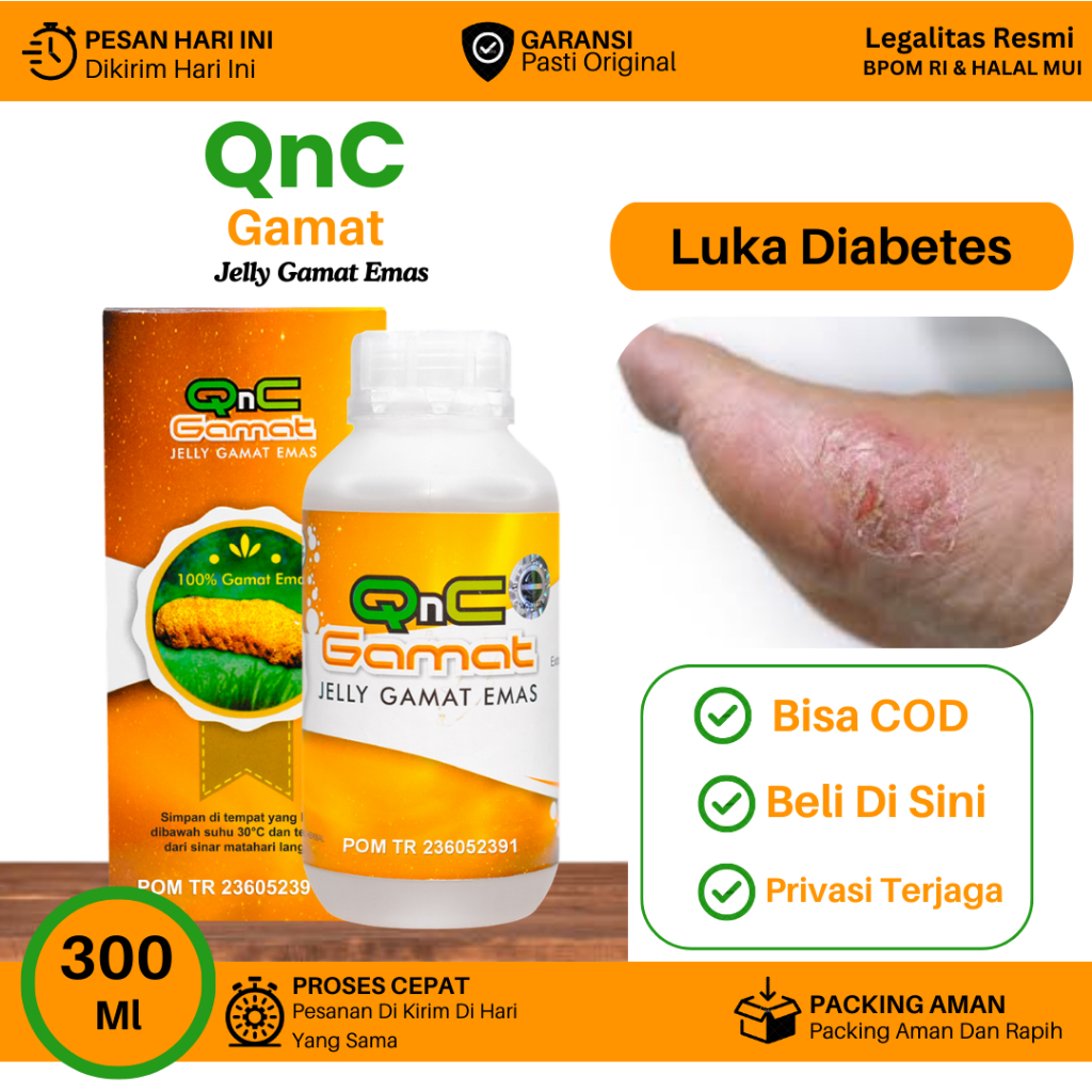 Obat Untuk Pengering Luka Diabetes, Luka Diabetes Bernanah, Luka Diabetes Melitus, Luka Basah Diabet