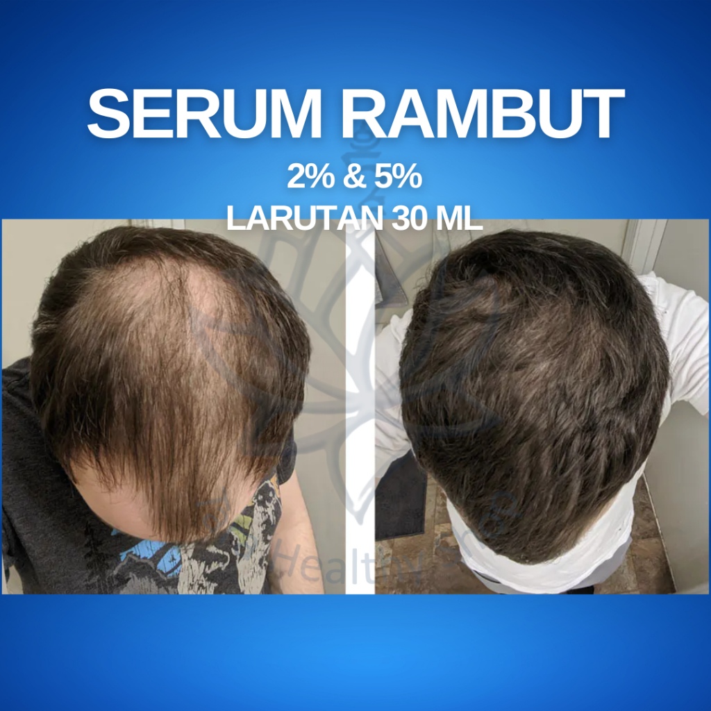 Serum Nutrisi Rambut Pria & Brewok High Concentrate (Solusi Kebotakan)