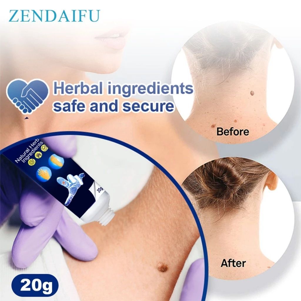 FMFIT SUMIFUN Wart Remover Ointment Skin Tag Remover Penghilang Tahilalat