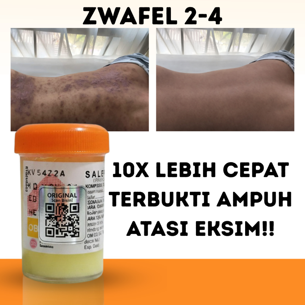 PROMO Salep Zwafel 2-4 Original BPOM Obat Scabies Anak & Dewasa Salep 24 Gatal Selangkangan Eksim QR