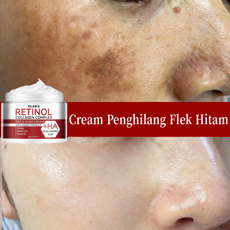 Retinol whitening cream Retinol flek hitam membandel Retinol cream glowing Cream retinol untuk flek 