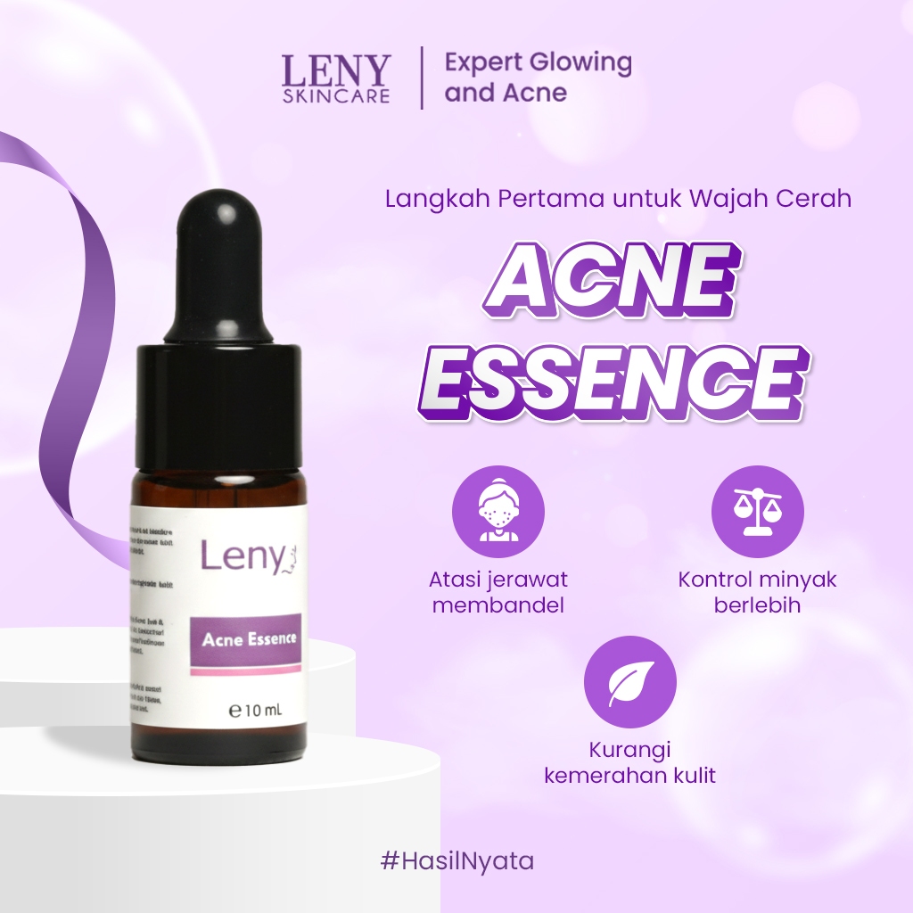 LENY SKINCARE Acne Essence 10 ml Meredakan Kulit Berjerawat