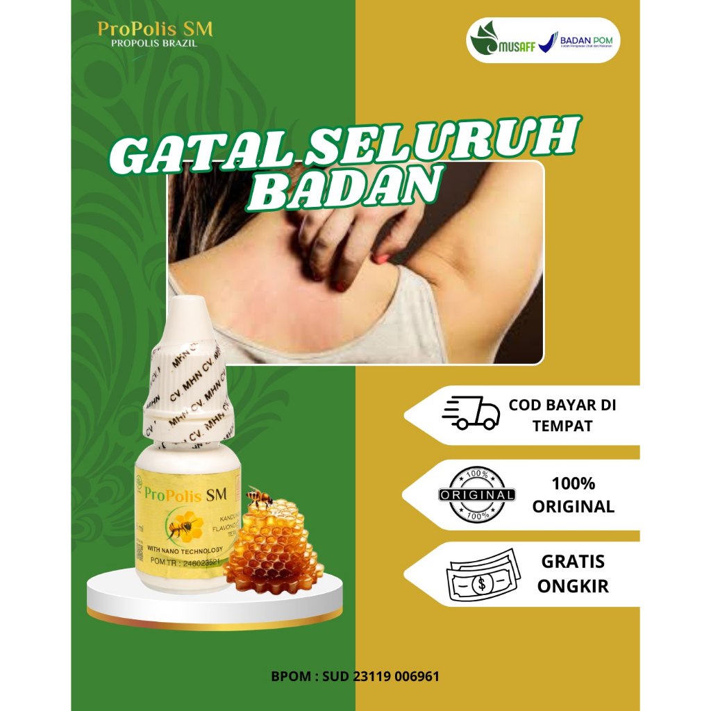 Obat Gatal Seluruh Badan, Obat Gatal Kelamin, Gatal Di Pantat, Obat Herbal Gatal Propolis SM