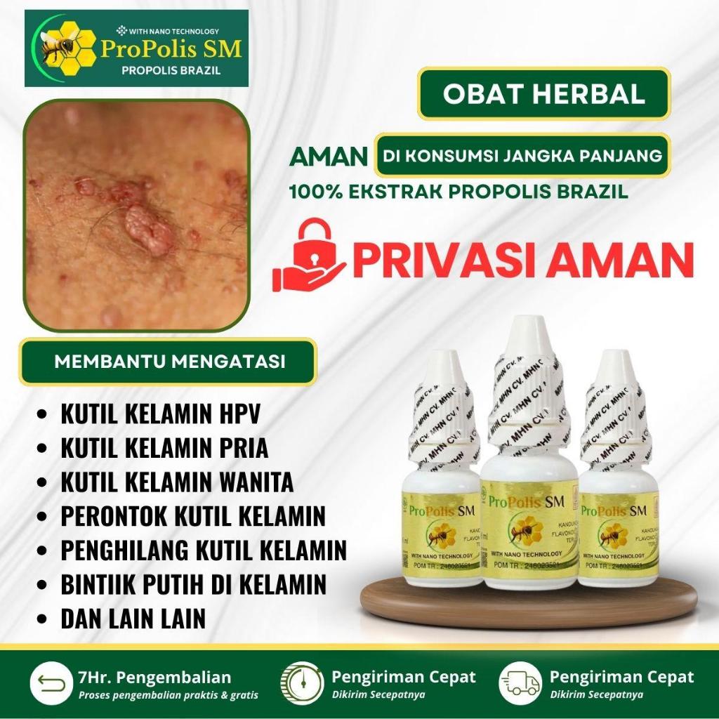 Kutil Kelamin HPV, Perontok Kutil Kelamin Jengger Ayam HPV, Penghilang Kutil Kelamin, Menghilangkan 